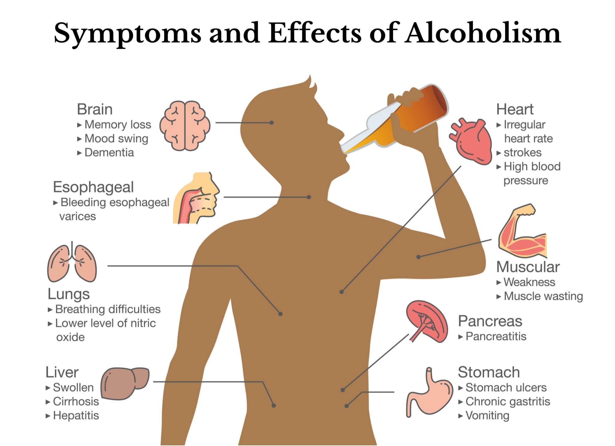 Alkohol rückenschmerzen